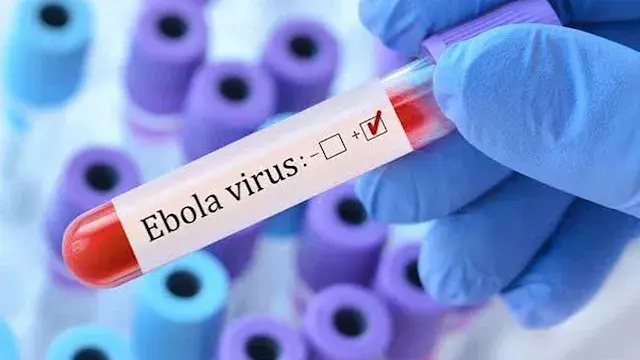 حصيلة جديدة.. الصحة الكينية: ارتفاع إصابات فيروس إيبولا لـ8 حالات