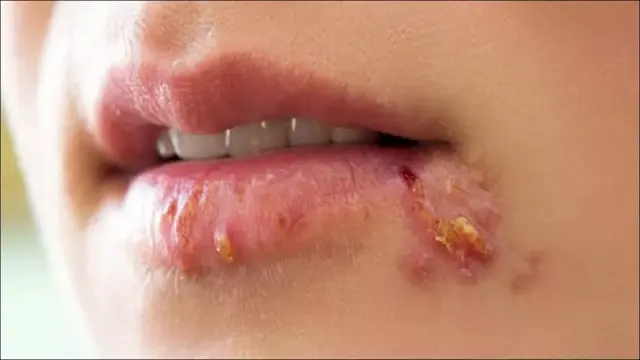 عادات يومية قد تساعد على تقليل...