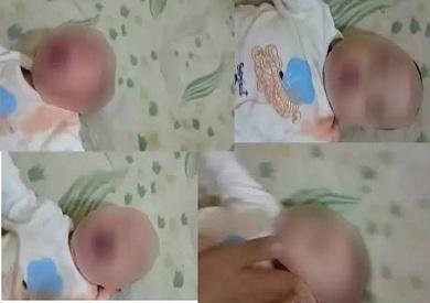 بعد صفع رضيعها.. مدير عام نجدة الطفل يكشف الموقف من الأم المعتدية