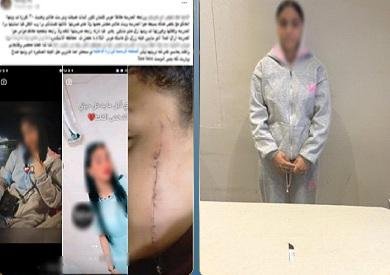 بجرح قطعي في الوجه.. ضبط طالبة متهمة بالتعدي على زميلتها بآلة حادة أمام مدرسة في الإسكندرية