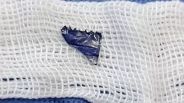 بعد شهر ونصف من صعوبة التنفس.....