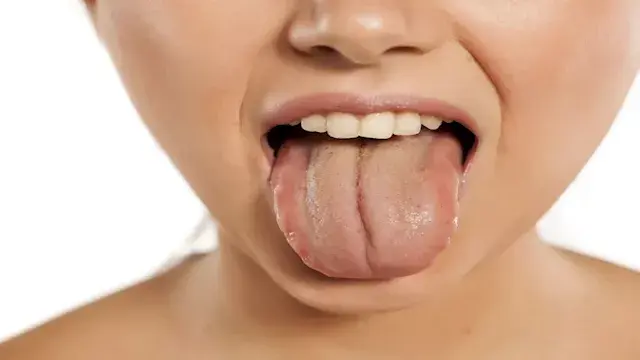 5 أسباب تجعلك تستيقظ بفم جاف ص...