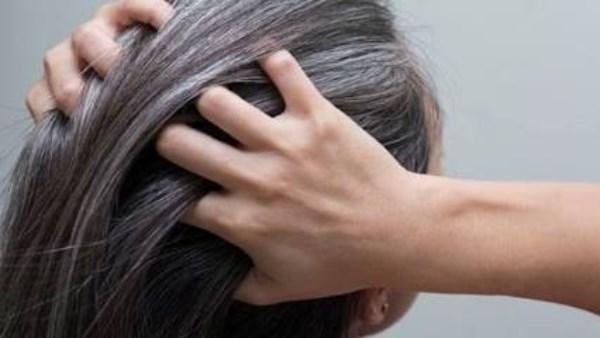 طرق التخلص من الشيب نهائيًا.. هل يمكن استعادة لون الشعر الطبيعي بوصفات منزلية؟