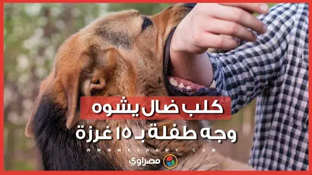 كلب يهاجم طفلة وينقلها للمستشفى بحالة حرجة