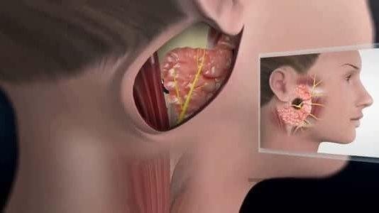 كل ما لا تعرفه عن الغدة النكافية.. الأعراض والمضاعفات وطرق الوقاية