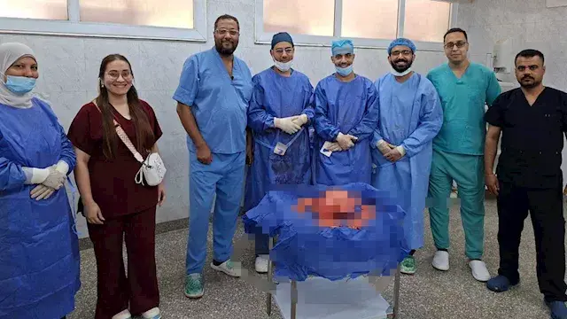 حالة نادرة لا تتكرر.. طبيب يرو...