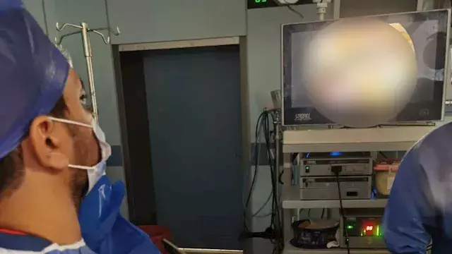 نجاح أول جراحة لاستئصال "الغدة...