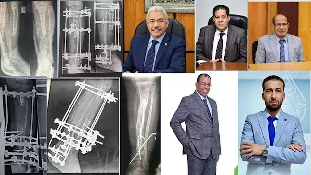فقد ثلث عظام الساق.. نجاح جراح...