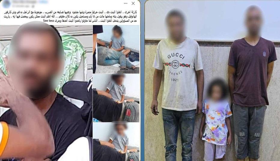 كشف ملابسات تداول صور طفلة مصا...