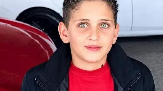 رحيل «طفل السكوتر» في بورسعيد.. 6 ساعات جراحة لم تنجح في إنقاذ حياته