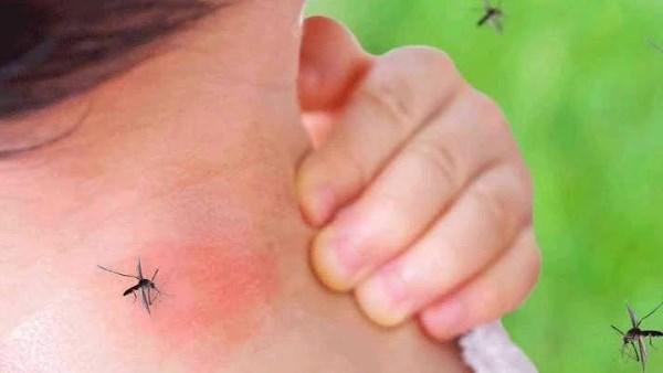 إصابات قياسية.. فلوريدا تعلن الطوارئ الصحية لمواجهة تفشي حمى الضنك